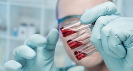 Tout savoir sur le virus Ebola